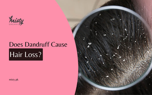 Does Dandruff Cause Hair Loss