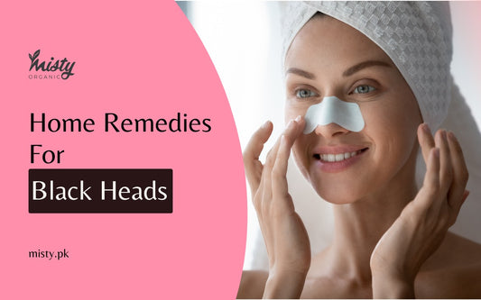 home remedies for black heads